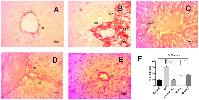 Fig 11
