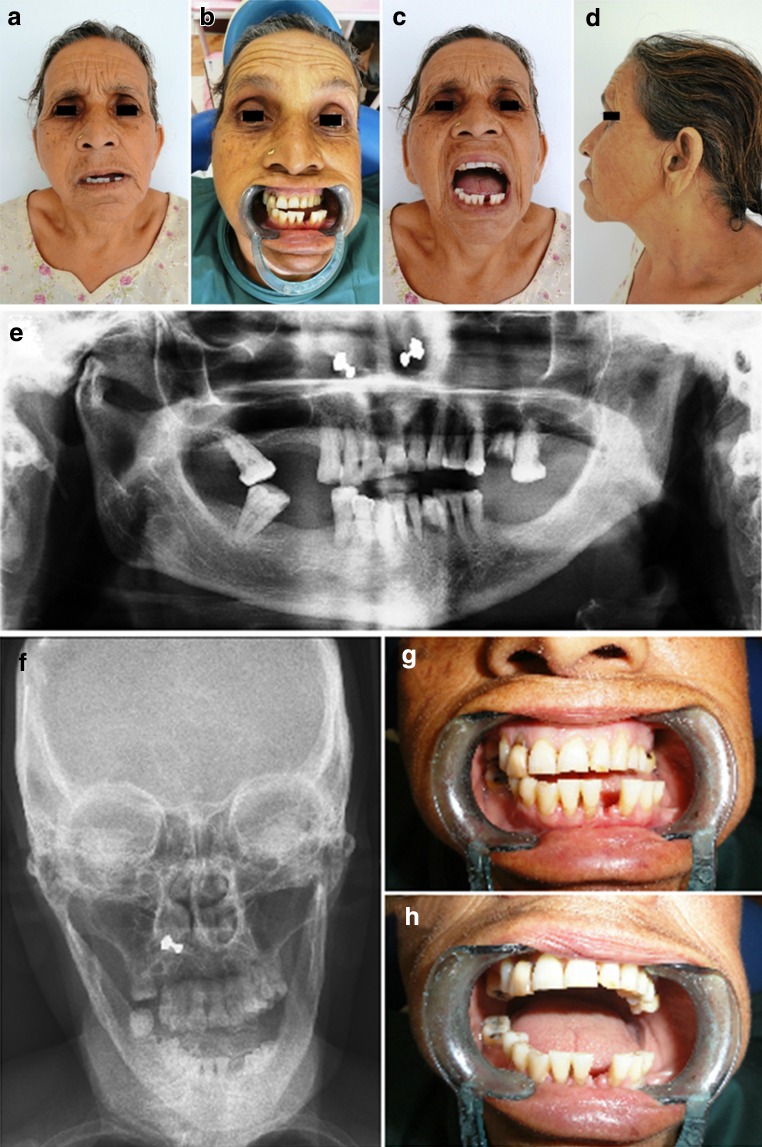 Fig. 1