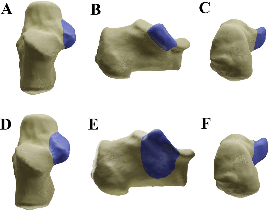 Fig. 1