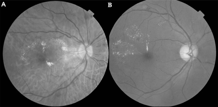 Fig. (1)