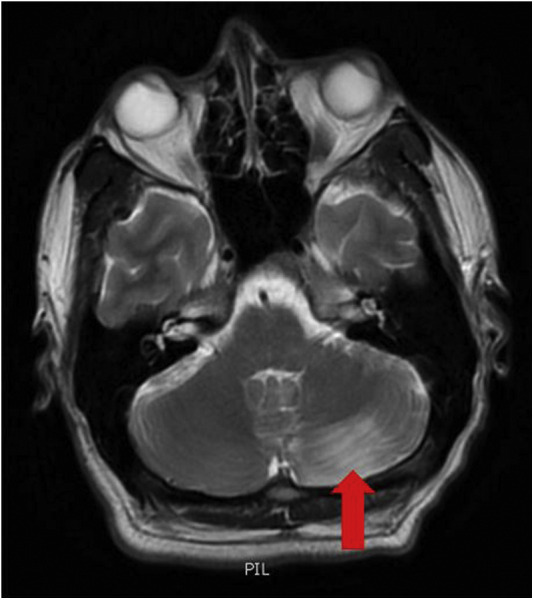 Figure 2