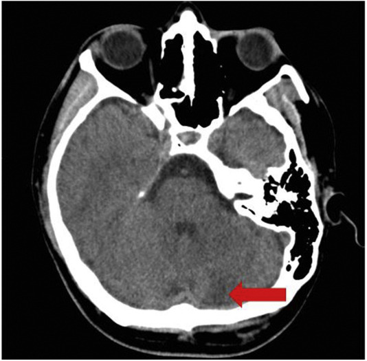 Figure 1