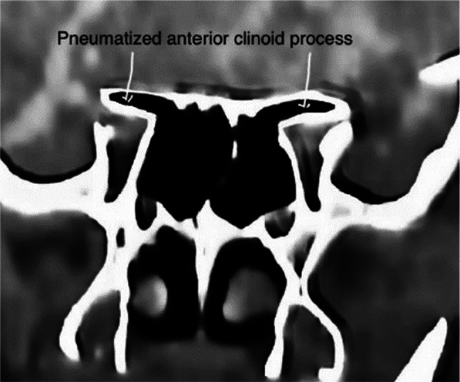 Fig. 13