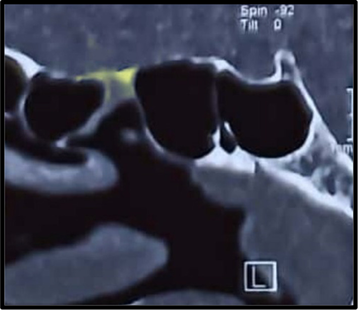 Fig. 9
