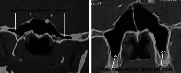 Fig. 12