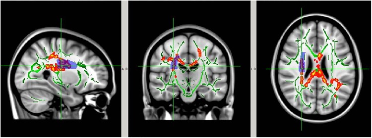 Figure 10