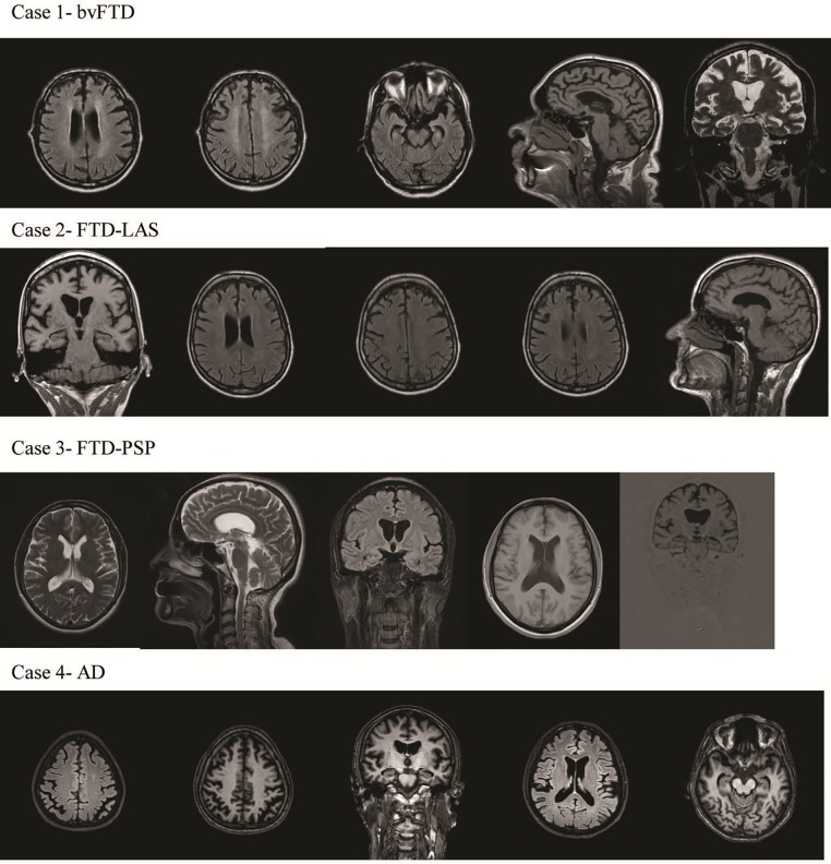 Fig 2