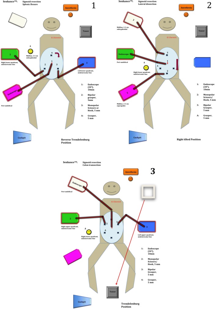 Fig. 3