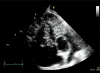 Figure 1c