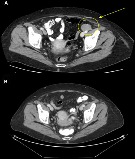 Figure 3