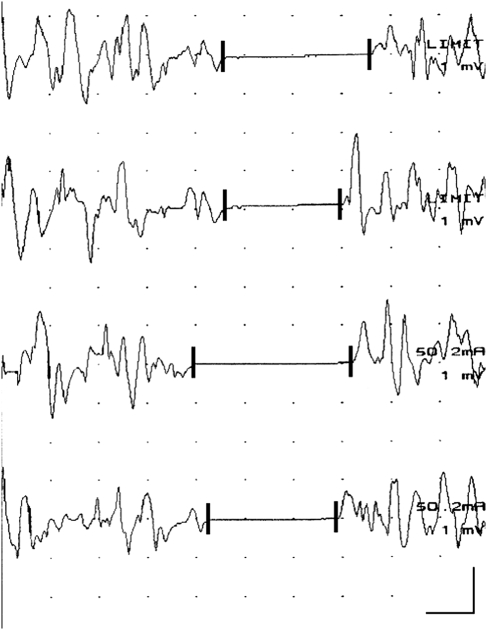 Fig. 1