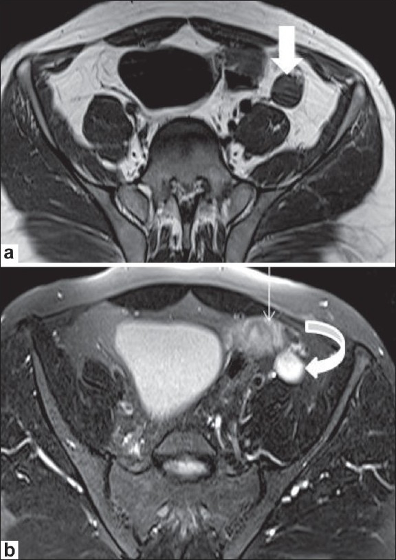 Figure 4 (a,b)