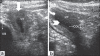 Figure 1 (a,b)