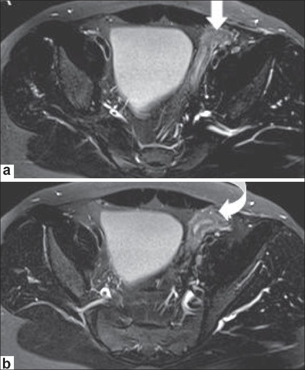 Figure 3 (a,b)