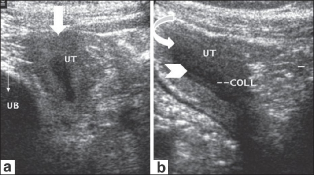 Figure 1 (a,b)