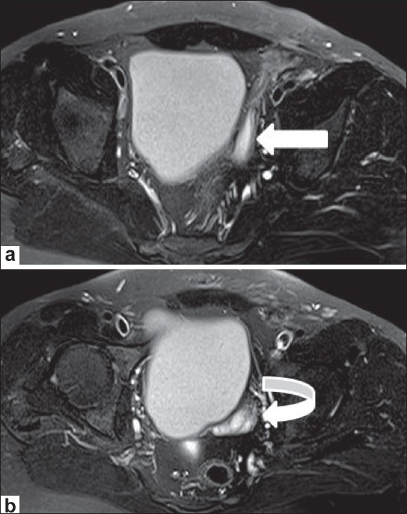 Figure 5 (a,b)