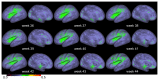 Figure 21