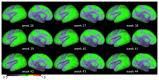 Figure 22