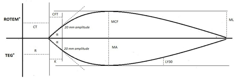 TEG® and ROTEM® Traces: Clinical Applications of Viscoelastic ...