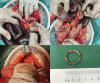 Four images labeled A to D, depicting a surgical procedure. Image A shows gloved hands examining internal organs. Image B reveals a surgical view with instruments manipulating the organs. Image C focuses on a close-up of surgical exploration. Image D displays a circular object on a green surface next to a measuring scale.
