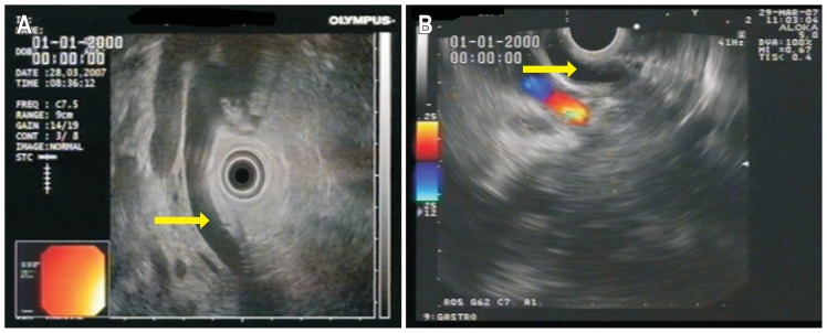 Fig. 6