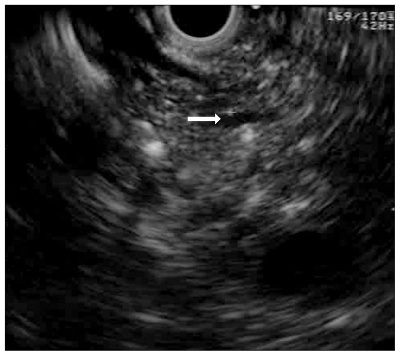 Fig. 10