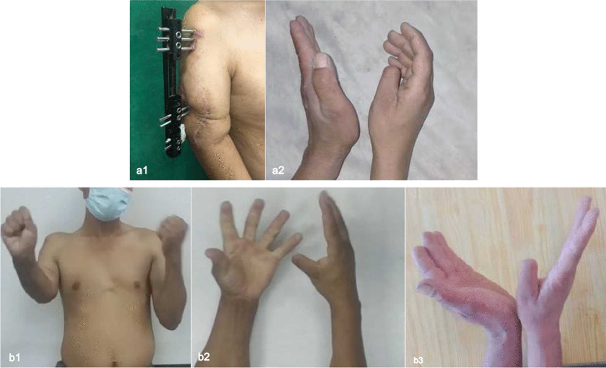 Fig. 3