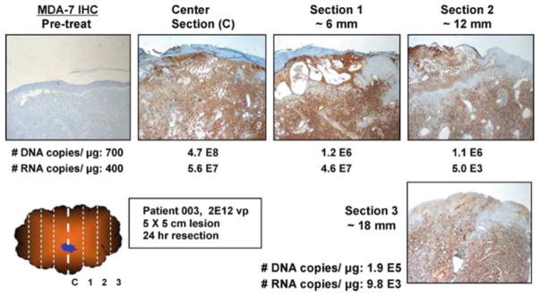 Fig. 6.6