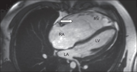 Fig. 4