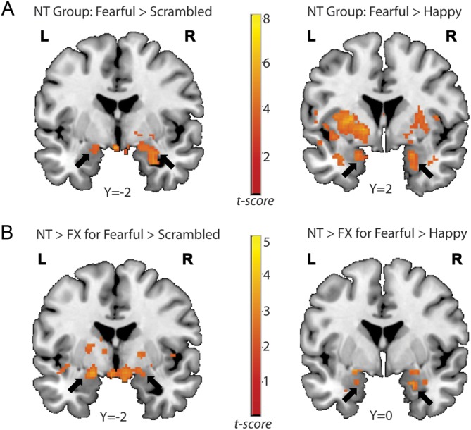 Figure 2.