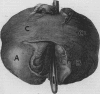 246