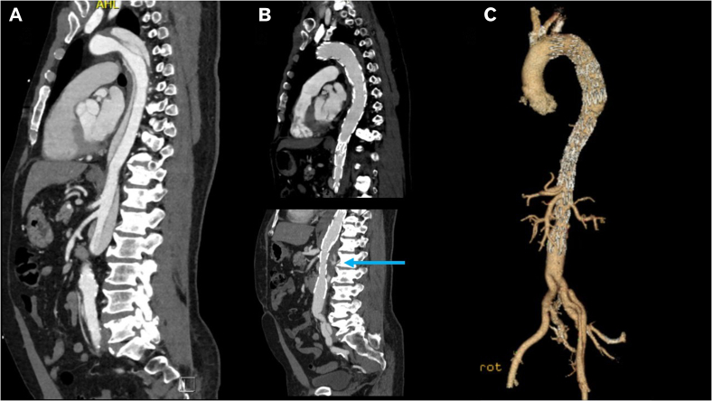 Fig 4