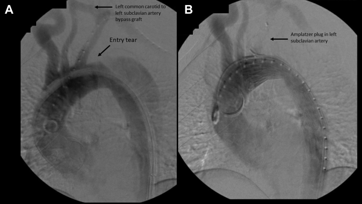 Fig 3