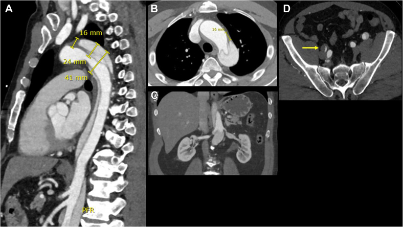 Fig 1