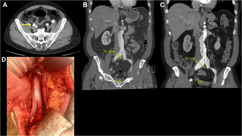 Fig 2