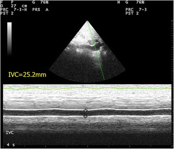 Fig. 15