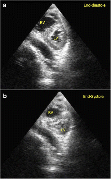 Fig. 11