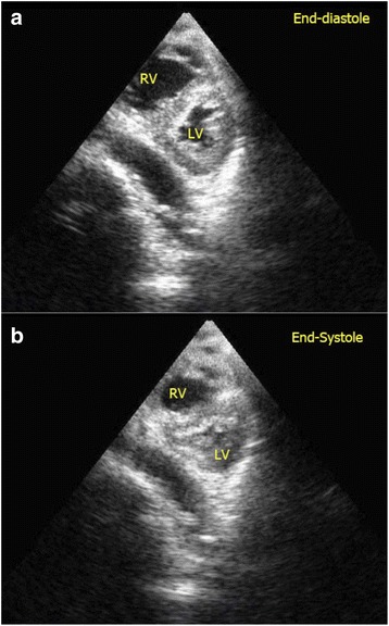 Fig. 11