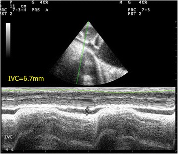 Fig. 12