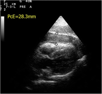 Fig. 16