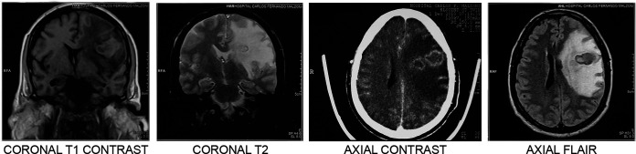 FIG 6