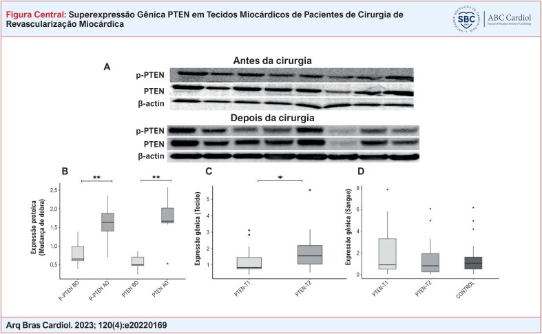 Resultados de expressão gênica e Western Blot de pacientes com DAC. Imagens de membrana dos níveis de proteína PTEN e P-PTEN determinados por anticorpos específicos em tecidos miocárdicos de pacientes do sexo feminino/masculino (A). Achados de expressão proteica de PTEN e P-PTEN em tecido miocárdico retirado de pacientes antes e após a cirurgia. A β-actina foi usada como controle de carregamento (B). A expressão gênica do PTEN foi determinada por PCR quantitativo em tempo real (qRT-PCR) em tecidos miocárdicos retirados de pacientes em 2 momentos diferentes (C). A expressão gênica do PTEN foi determinada por PCR quantitativo em tempo real (qRT-PCR) em amostras de sangue colhidas de pacientes em 2 momentos diferentes e em amostras de sangue de controle (D). Comparações: P-PTEN AC vs. P-PTEN DC, PTEN AC vs. PTEN DC, e PTEN-T1 vs. PTEN-T2 (em amostras de sangue e tecido separadamente) via teste Wilcoxon Signed Rand; PTEN-T1 vs. Controle e PTEN-T2 vs. Controle via teste U de Mann-Whitney (*p<0,05, **p<0,001). (T1: antes da circulação extracorpórea, T2: depois da circulação extracorpórea).