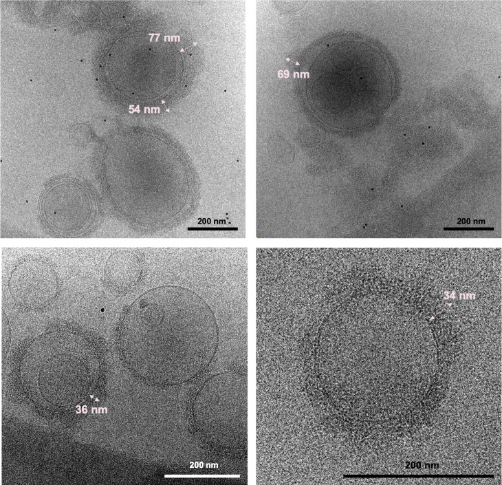 Figure 4—figure supplement 2.