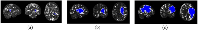 Fig. 2