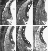 FIG. 11