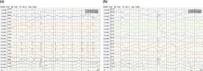 FIGURE 3