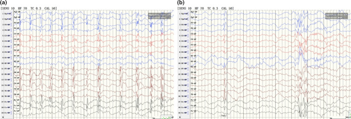 FIGURE 2