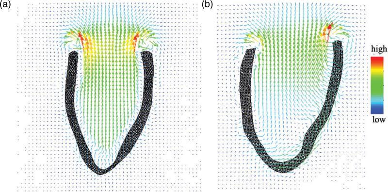 Fig. 13