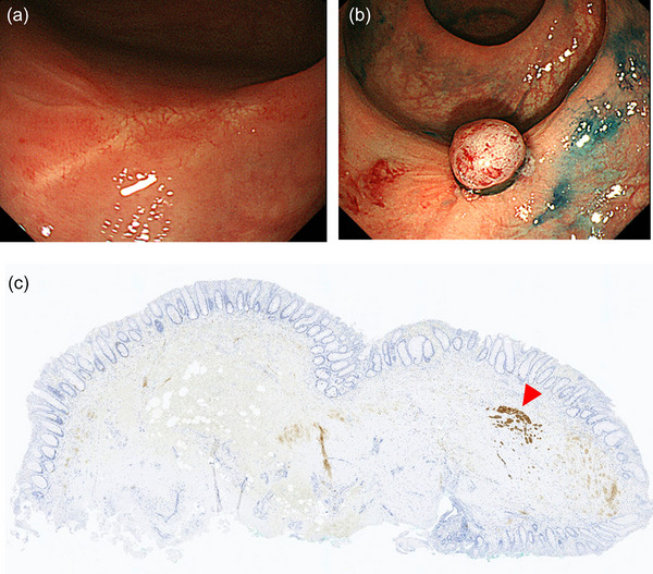 FIGURE 3