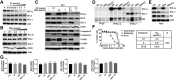 Figure 3. Synergy between DT2216 and gemcitabine attributes to a combined depletion of BCL-XL and MCL-1. A, Immunoblot analysis of BCL-XL, BCL-2, and MCL-1 in G-68 cells after they were treated with the indicated concentrations of DT2216 (DT) for 16 hours. B, Immunoblot analysis of BCL-XL, BCL-2, MCL-1, and NOXA in G-68 cells after they were treated with the indicated concentrations of gemcitabine (GEM) for 48 hours. C, Immunoblot analysis of BCL-XL, BCL-2, MCL-1, NOXA, and apoptosis markers – cleaved (C) and full-length caspase-3 and PARP in G-68 cells after they were treated with the indicated concentrations of gemcitabine and/or DT for 48 hours. Immunoblots presented in A-C are representative of three independent experiments. D, G-68 cells were treated with gemcitabine (1 μmol/L) and/or DT (0.1 μmol/L) for 48 hours. Cell lysates were subjected to co-immunoprecipitation (Co-IP) using BCL-XL or MCL-1 antibodies followed by immunoblotting to detect BCL-XL, MCL-1, and BIM. E, The levels of BCL-XL, MCL-1, and BIM in the inputs for D. β-actin was used as an equal loading control for all immunoblot analyses presented in A–E. F, Viability of G-68 cells after they were treated with increasing concentrations of DT or S63845 (S) individually or in combination (DT+S) for 72 hours. IC50 values are shown in the table. The CI value indicates a synergy between DT and S. G, G-68 cells were treated with 0.1 μmol/L of DT or 1 μmol/L of gemcitabine alone or in combination (gemcitabine + DT) for 48 hours. The fold changes in the expressions of BCL2L1 (encodes BCL-XL), BCL2, MCL1, and PMAIP1 (encodes NOXA) mRNA are shown. GAPDH was used as an internal control. Data are from a single experiment performed in triplicate (mean ± SD).